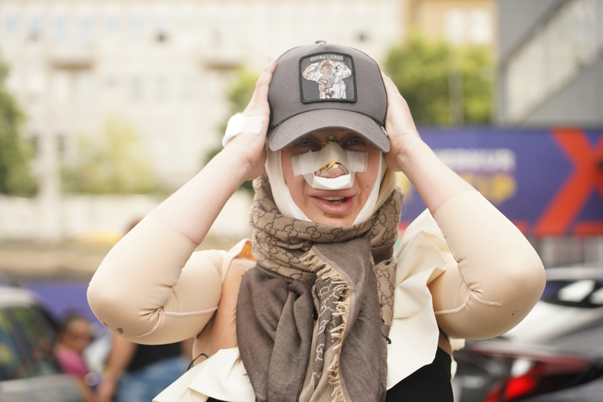 Foto Du Ica Jakovljevi Skinula Masku I Pokazala Lice Posle Pete