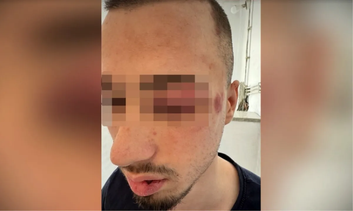 Ispovest majke maloletnika kog je pretukla grupa tinejdžera: Policija pustila osumnjičenog, Hitna pomoć ga sa teškim povredama poslala kući