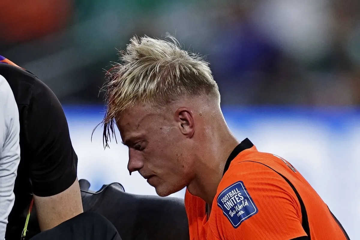 FOTO Krvave scene u Meksiku: Fudbaleru Holandije ušivana glava na terenu