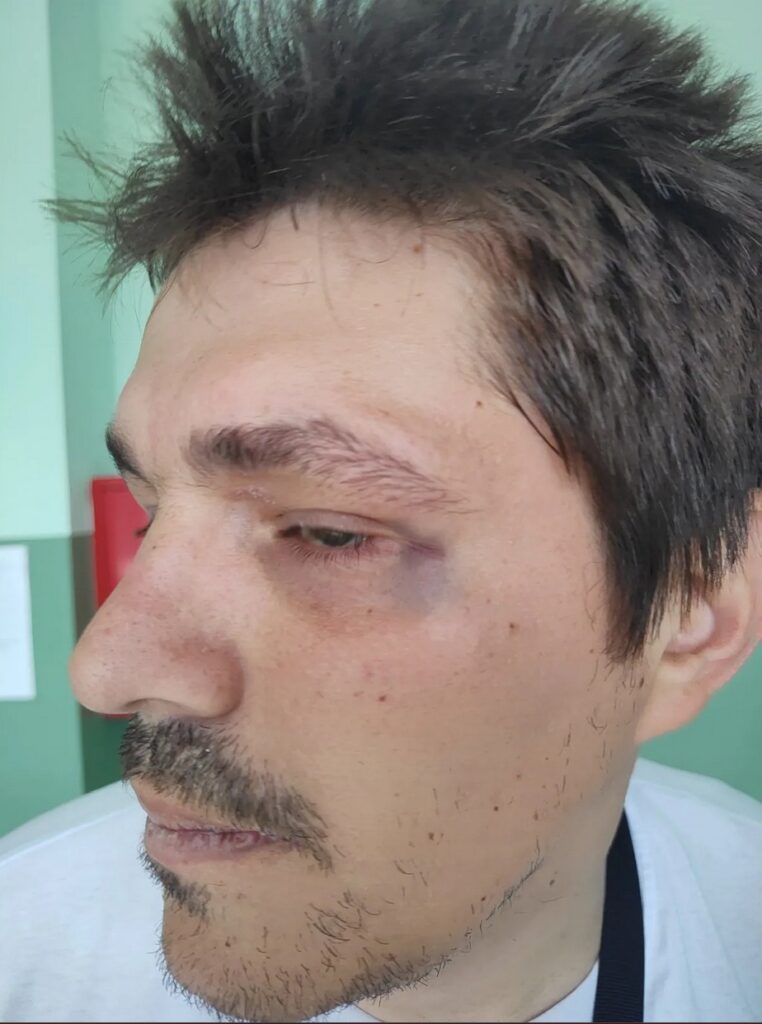 Opozicionog aktivistu Aleksu Pavlovića pretukao je član SNS i predsednik MZ Makovište Ljubiša Knežević, saopštila je lista "Ujedinjeni za Kosjerić"