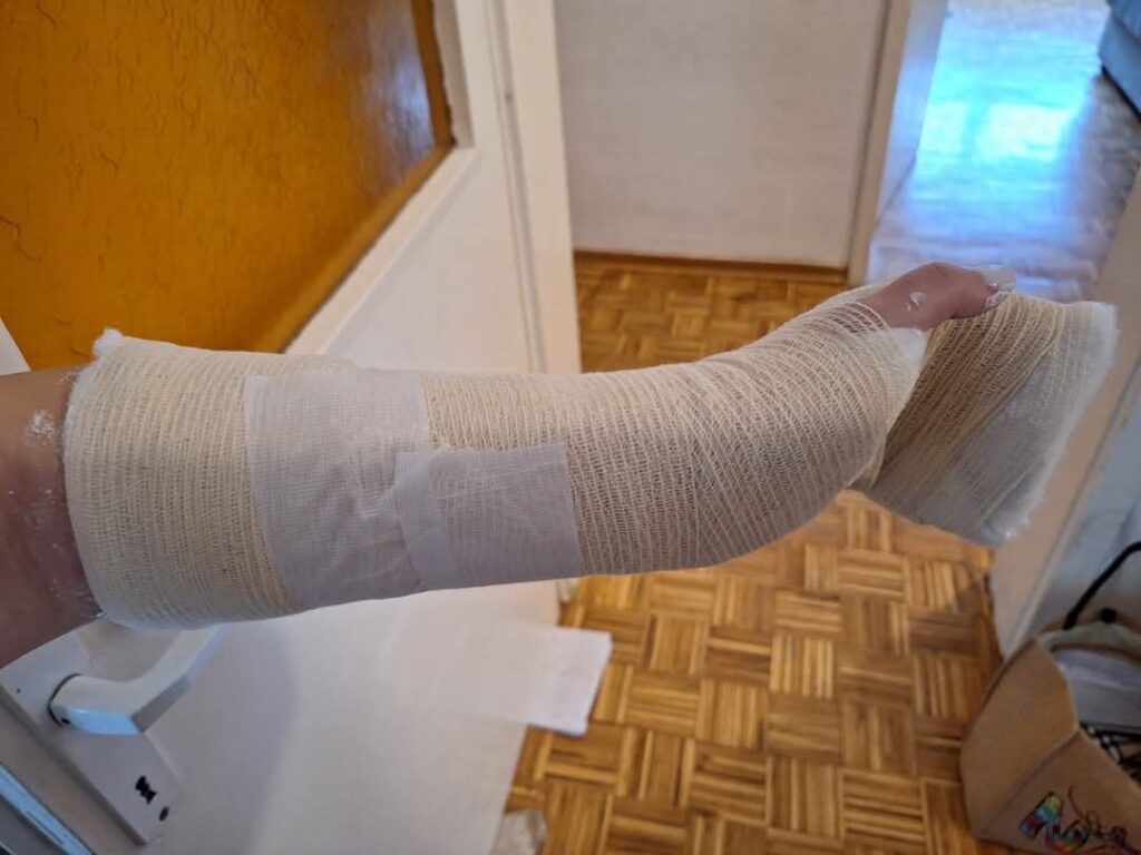 Rakovica, pretučeni dečak Foto: Miroslav Jelić