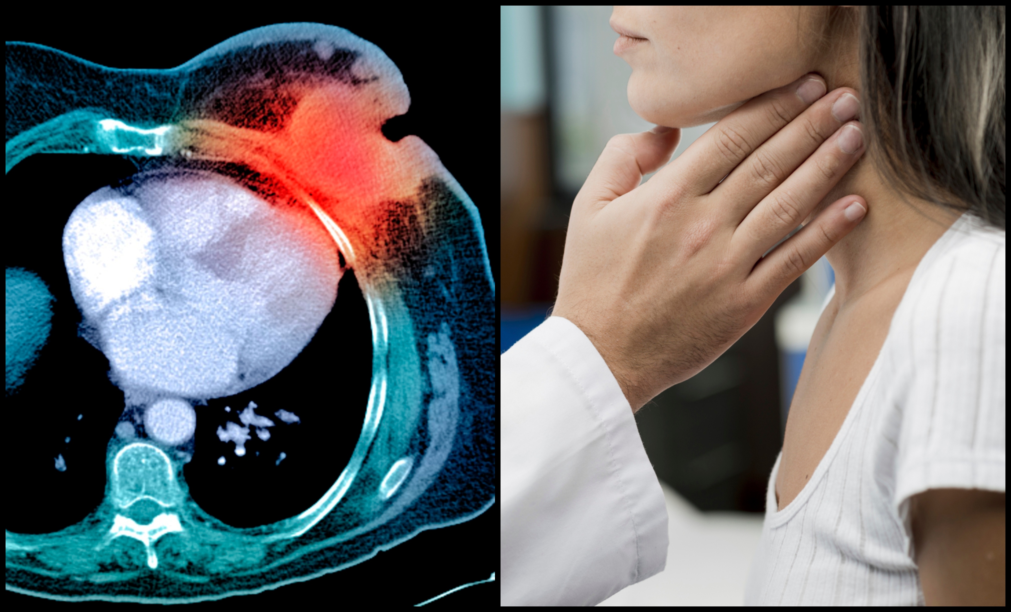 Naučnici misle da su pronašli razlog povećanog broja obolelih od raka
