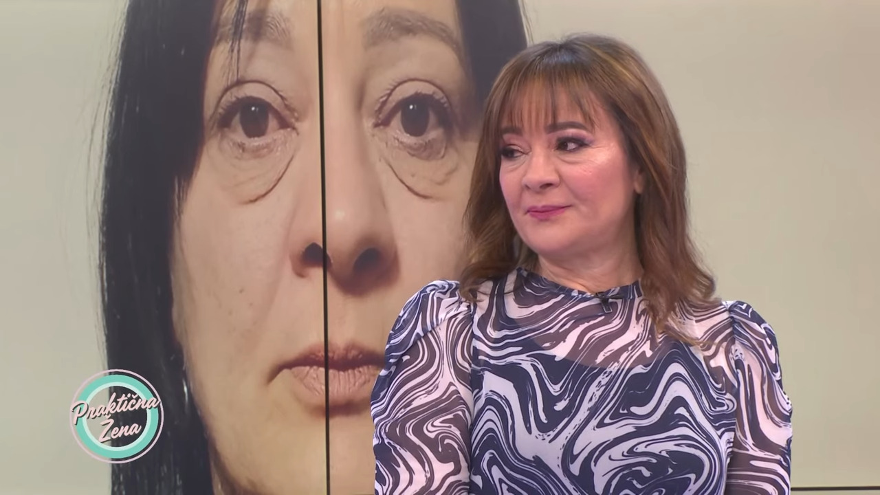 Foto: Printscreen/YouTube/Prakticna zena Praktična žena – Transformacija uklanjanje podočnjaka