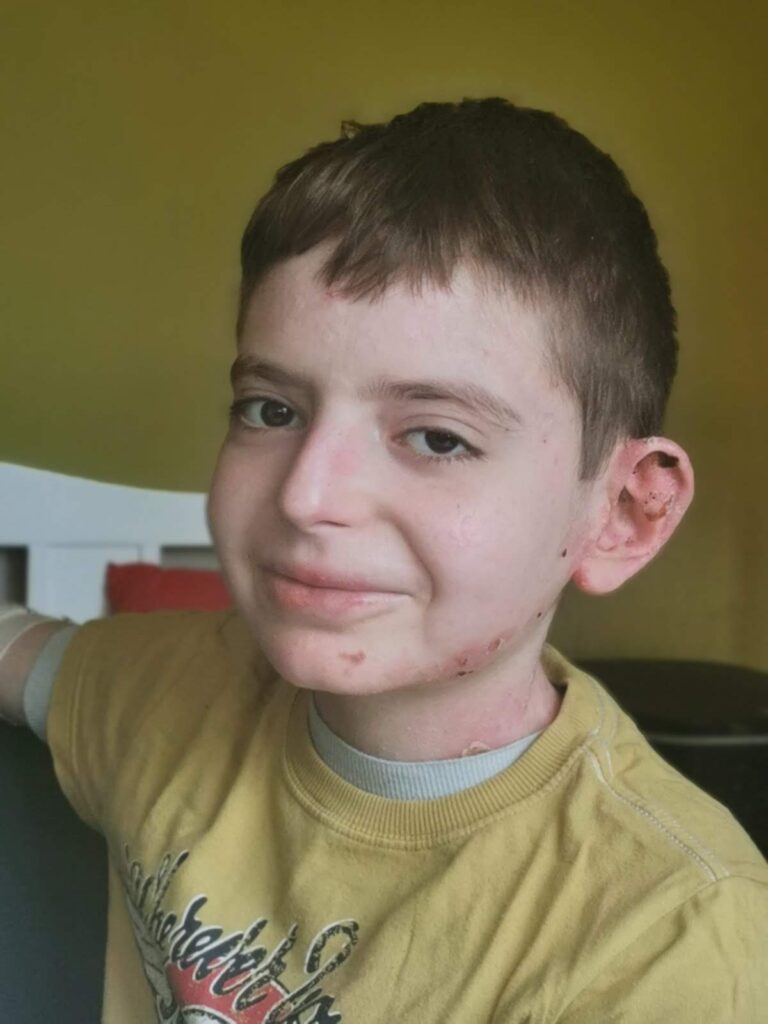 Snežana Janošević deca leptiri