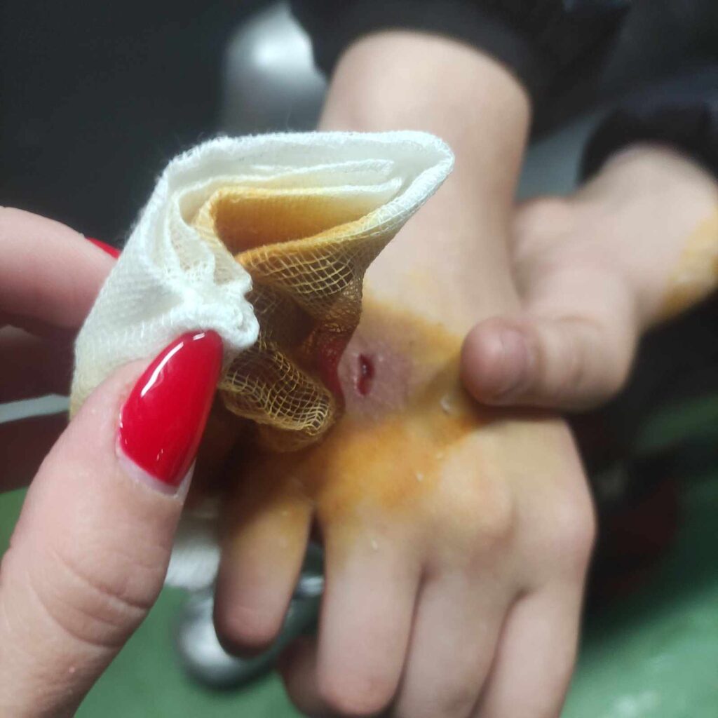 tekst o devojčici koju je ujeo pas Kane korso