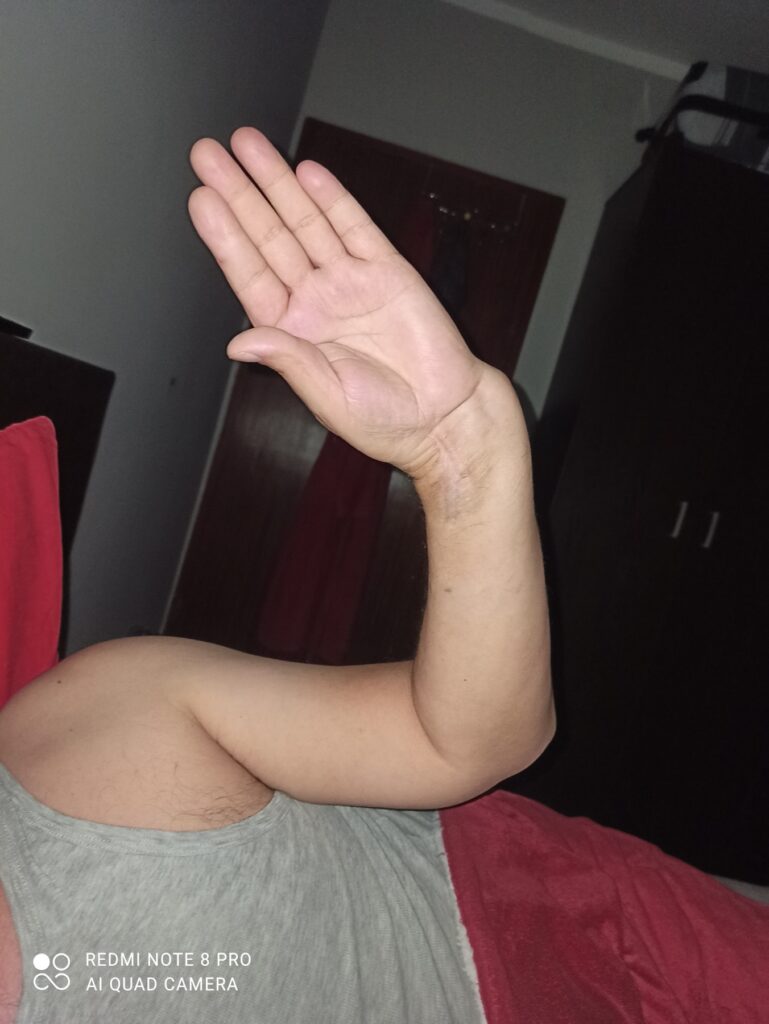 Bratislav Milenković (sa fotke, čovek za stolom) u fokus, jedna fotka iskrivljenog zgloba i ako negde nađete sliku Doma zdravlja Vlasotince, ako ne stavite i ovu porodičnu fotku