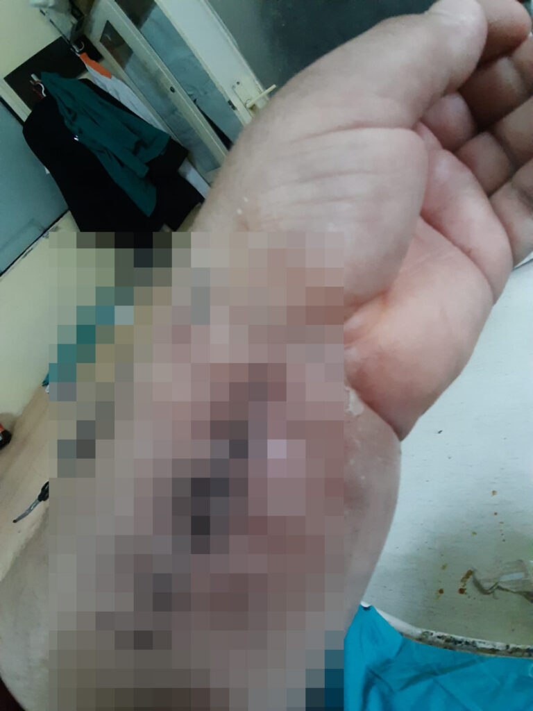 Bratislav Milenković (sa fotke, čovek za stolom) u fokus, jedna fotka iskrivljenog zgloba i ako negde nađete sliku Doma zdravlja Vlasotince, ako ne stavite i ovu porodičnu fotku