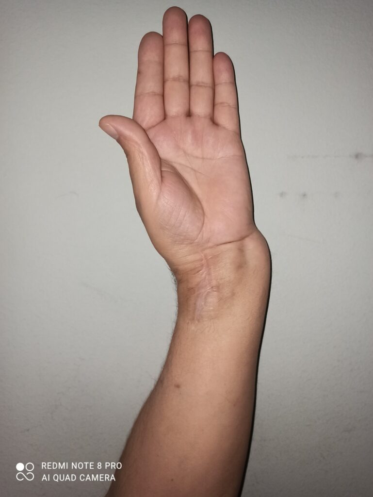 Bratislav Milenković (sa fotke, čovek za stolom) u fokus, jedna fotka iskrivljenog zgloba i ako negde nađete sliku Doma zdravlja Vlasotince, ako ne stavite i ovu porodičnu fotku