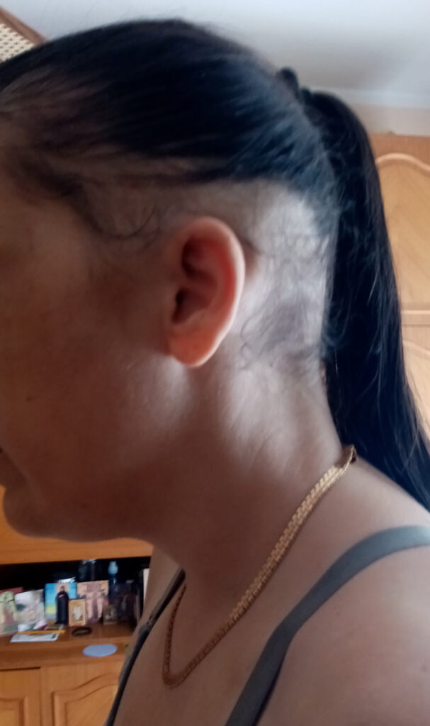 Barič, Ana Miketić koju je pretukao Nemanja u Bariču