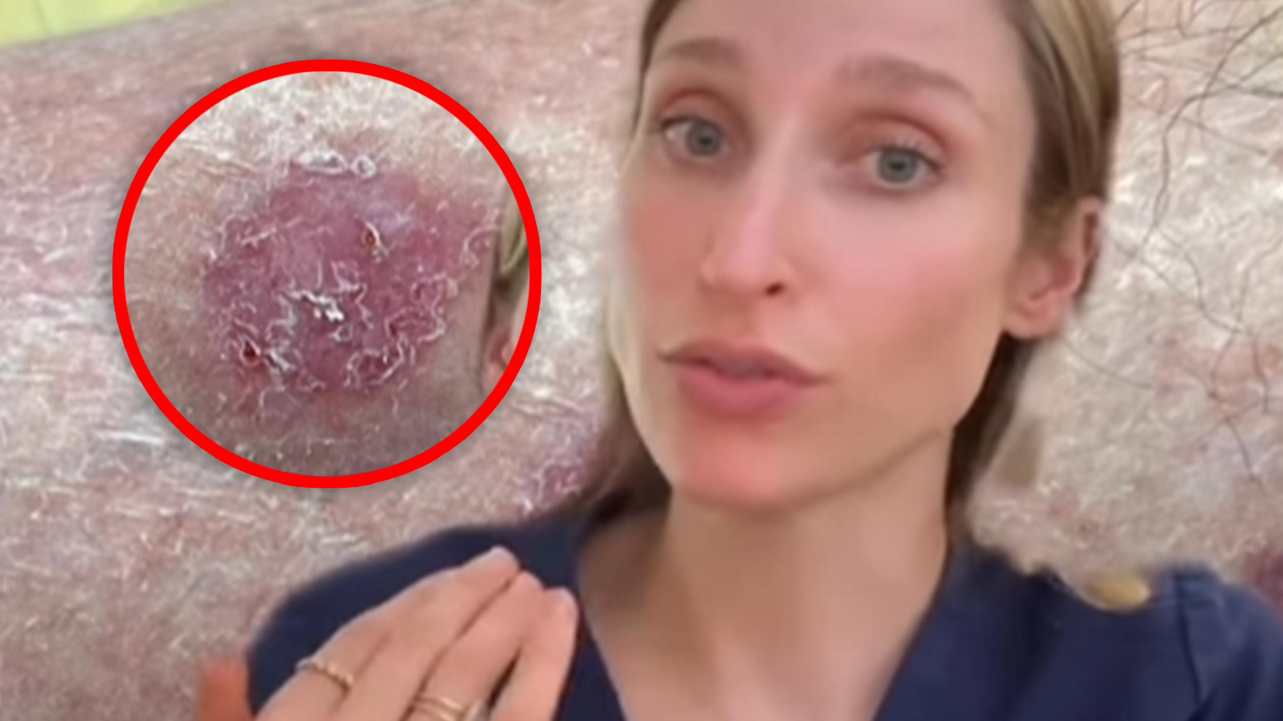 kst Dermatološkinja otkrila jedan od najčešćih simptoma raka kože za koji mnogi ne znaju