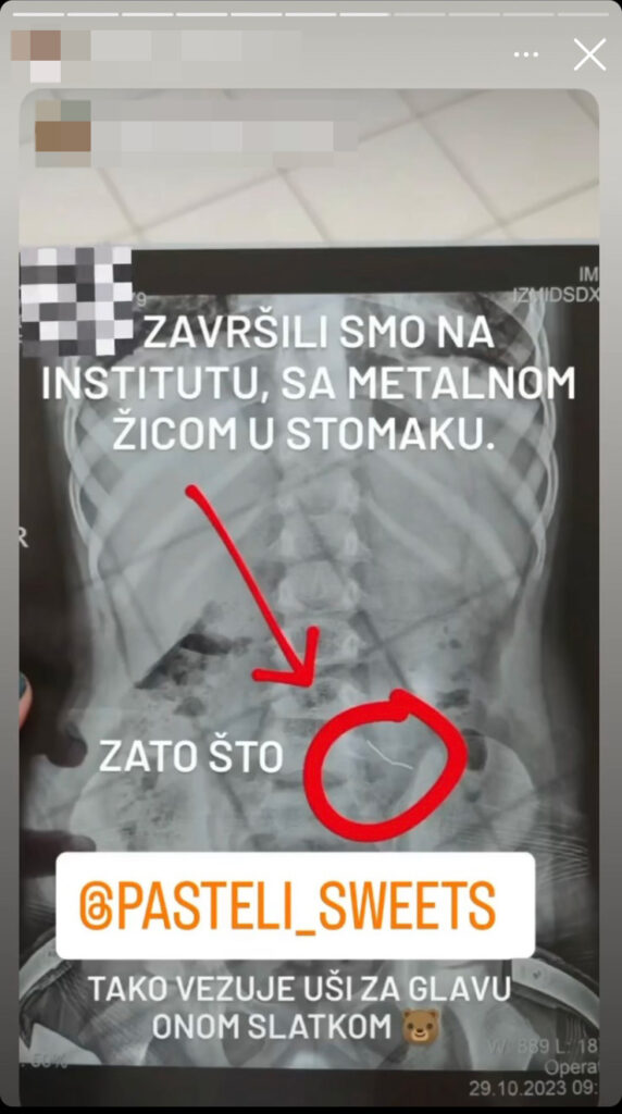 Metalna Žica, medvedići, mafini, Dete progutalo žicu na rodjendanu u mafinu