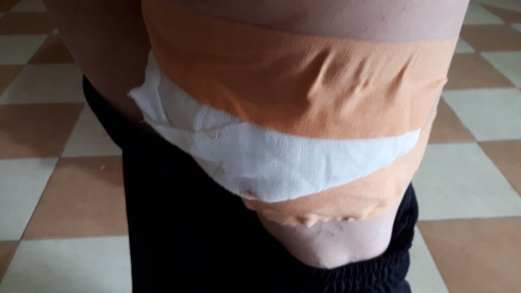 Zoricu iz Kamenice čopor pasa oborio na zemlju i ujedao, dečaka (14) ujeli za nogu