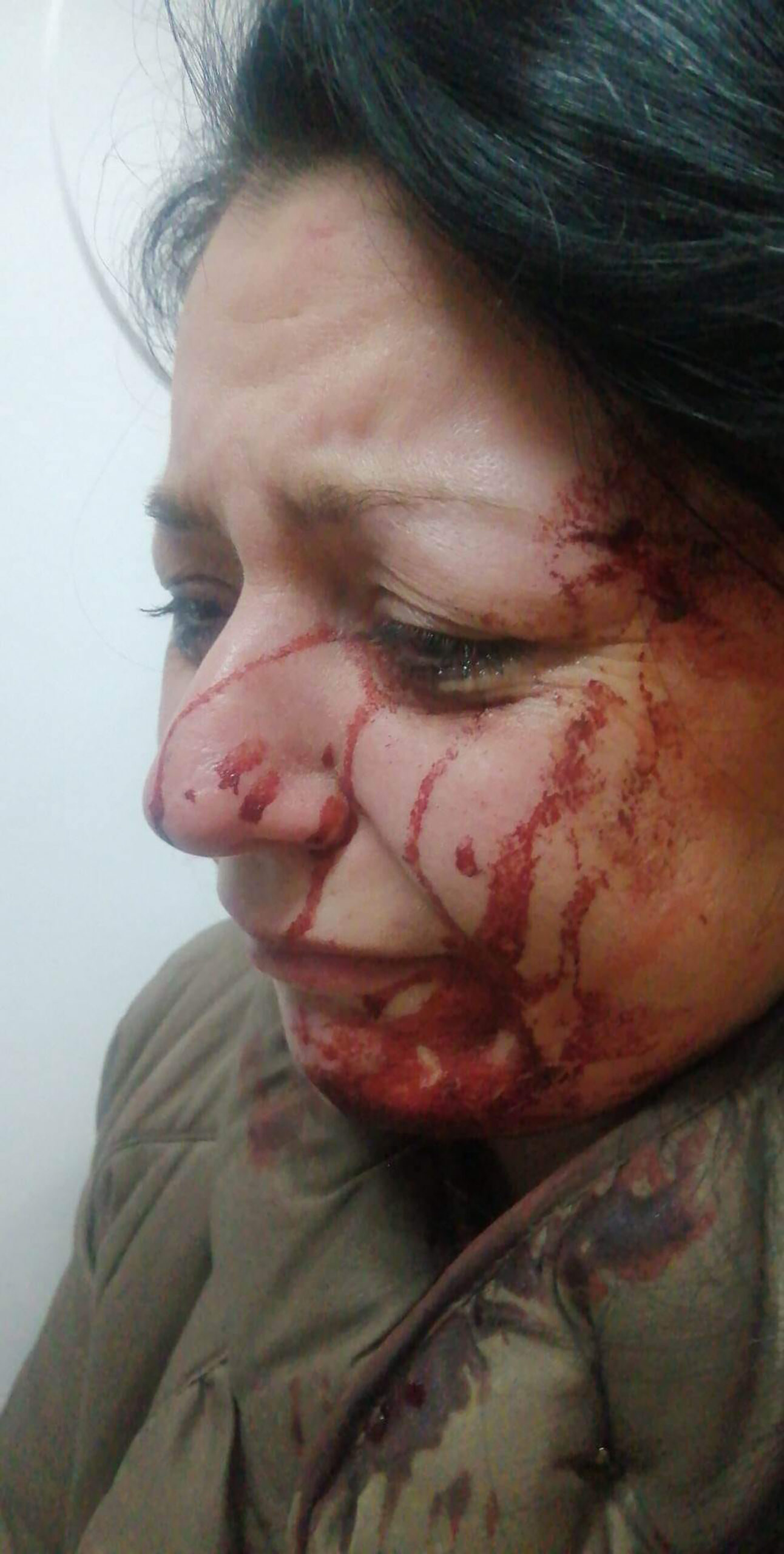 Tamara Novaković napao je pit bul