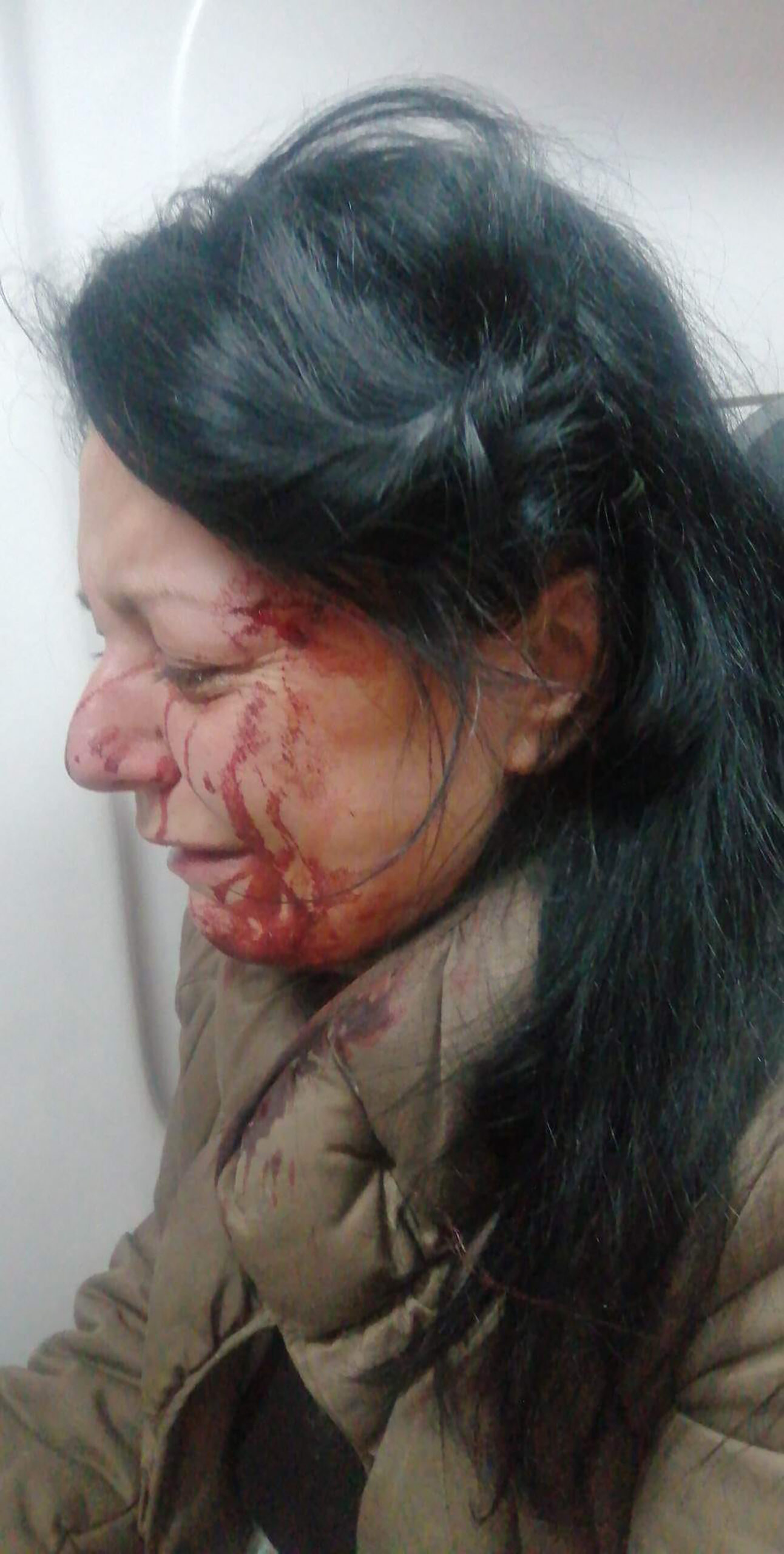 Tamara Novaković napao je pit bul