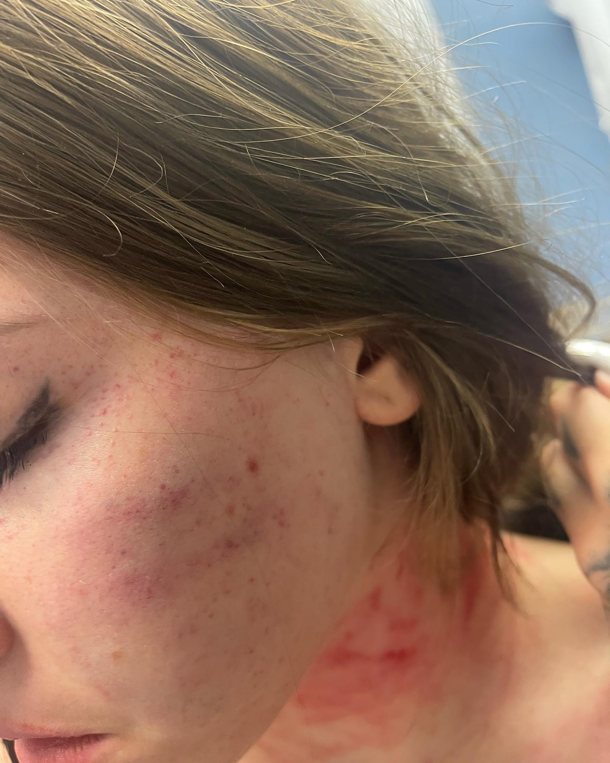 Una Kablar sestra  tiktok  nasilje, nasilje nad zenama, povrede
Sara Hadžić