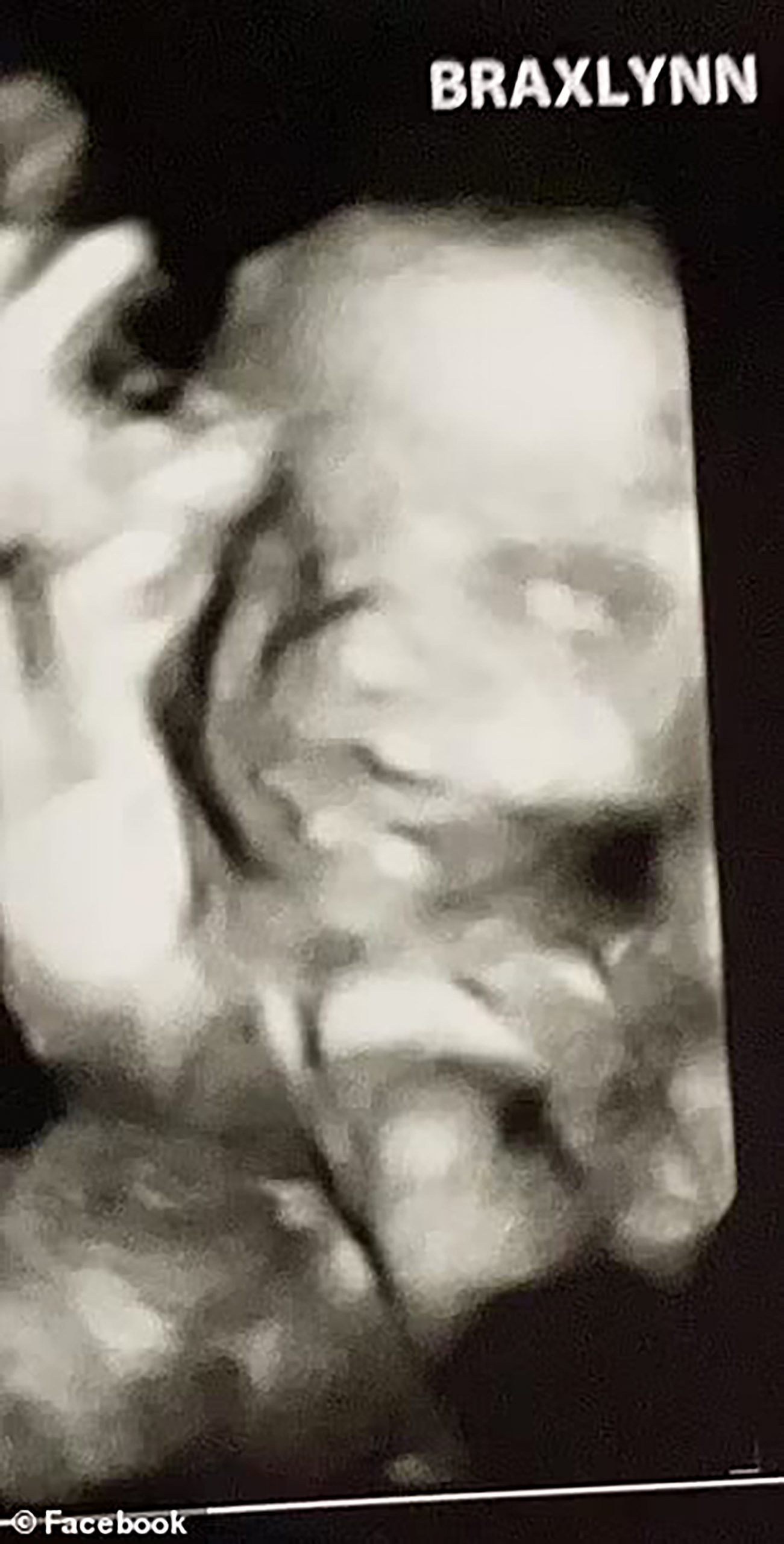 Parker cut out Reagan's baby, called Braxlynn Sage, after killing her mother by stabbing her with a scalpel and crushing her skull with a hammer