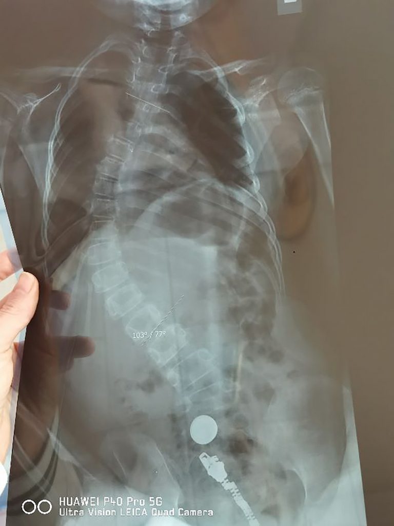 Sonja Milošević (ime devojčice)