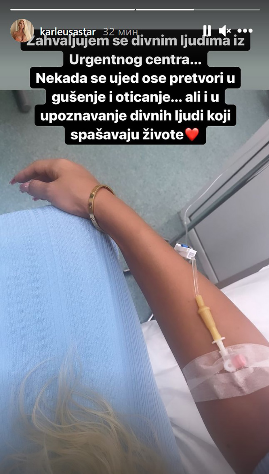 Jelena Karleuša, pevačica, urgentni centar, ujed ose, osa Foto: Instagram/karleusastar