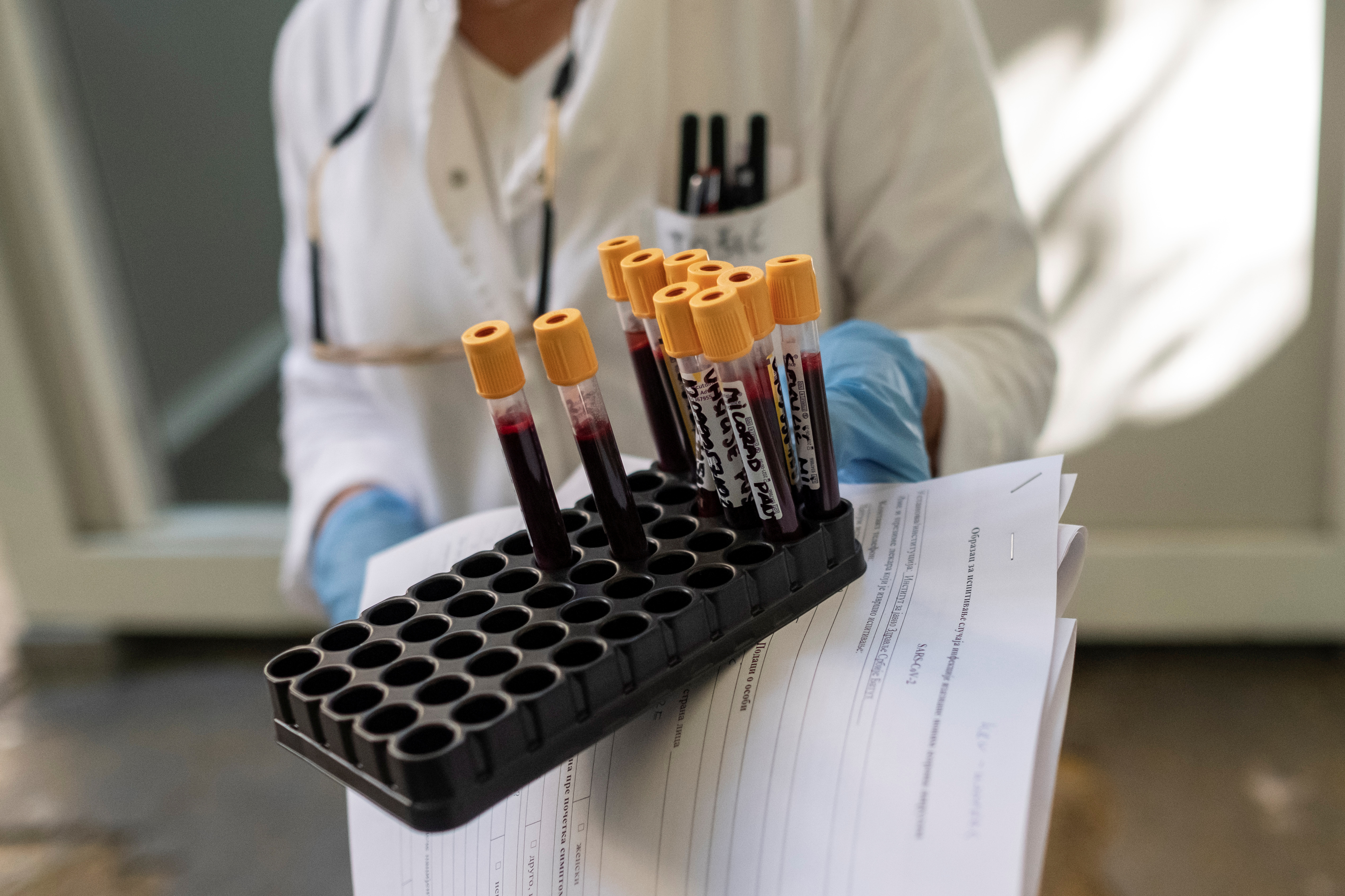 A medical worker carries blood from people for the coronavirus disease (COVID-19) test at the Institute of Public Health of Serbia "Dr Milan Jovanovic Batut" in Belgrade, Serbia June 26, 2020. REUTERS/Marko Djurica