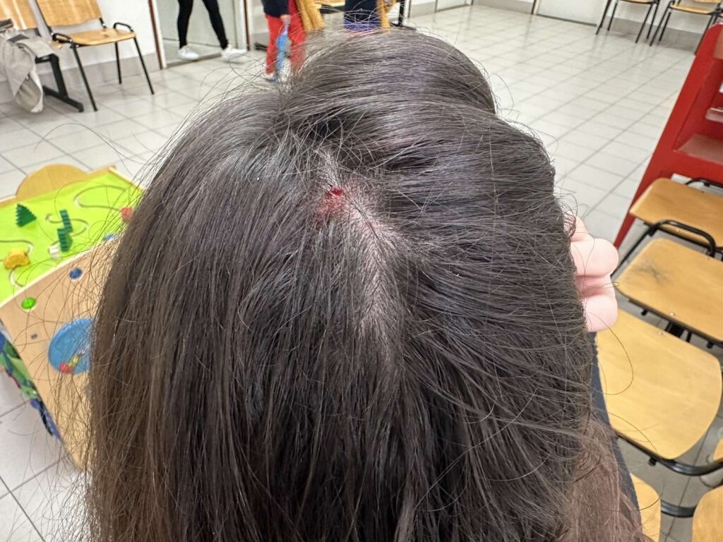 Dom zdravlja Stari grad, zatvoren ulaz