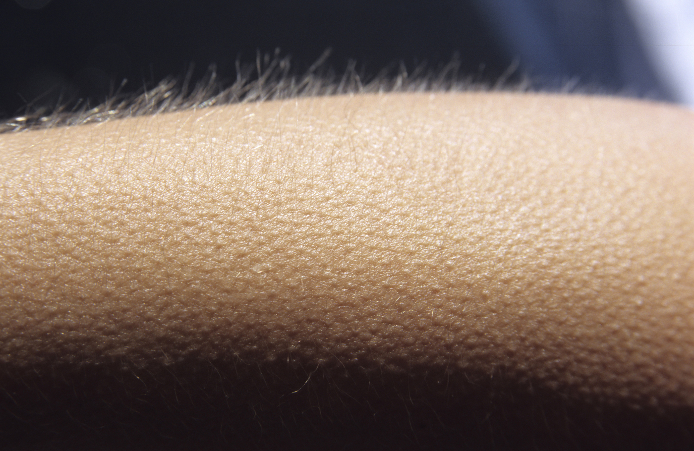 Close-up shot, goosebumps,Image: 43378010, License: Royalty-free, Restrictions: , Model Release: no, Credit line: Bele Olmez / imageBROKER / Profimedia