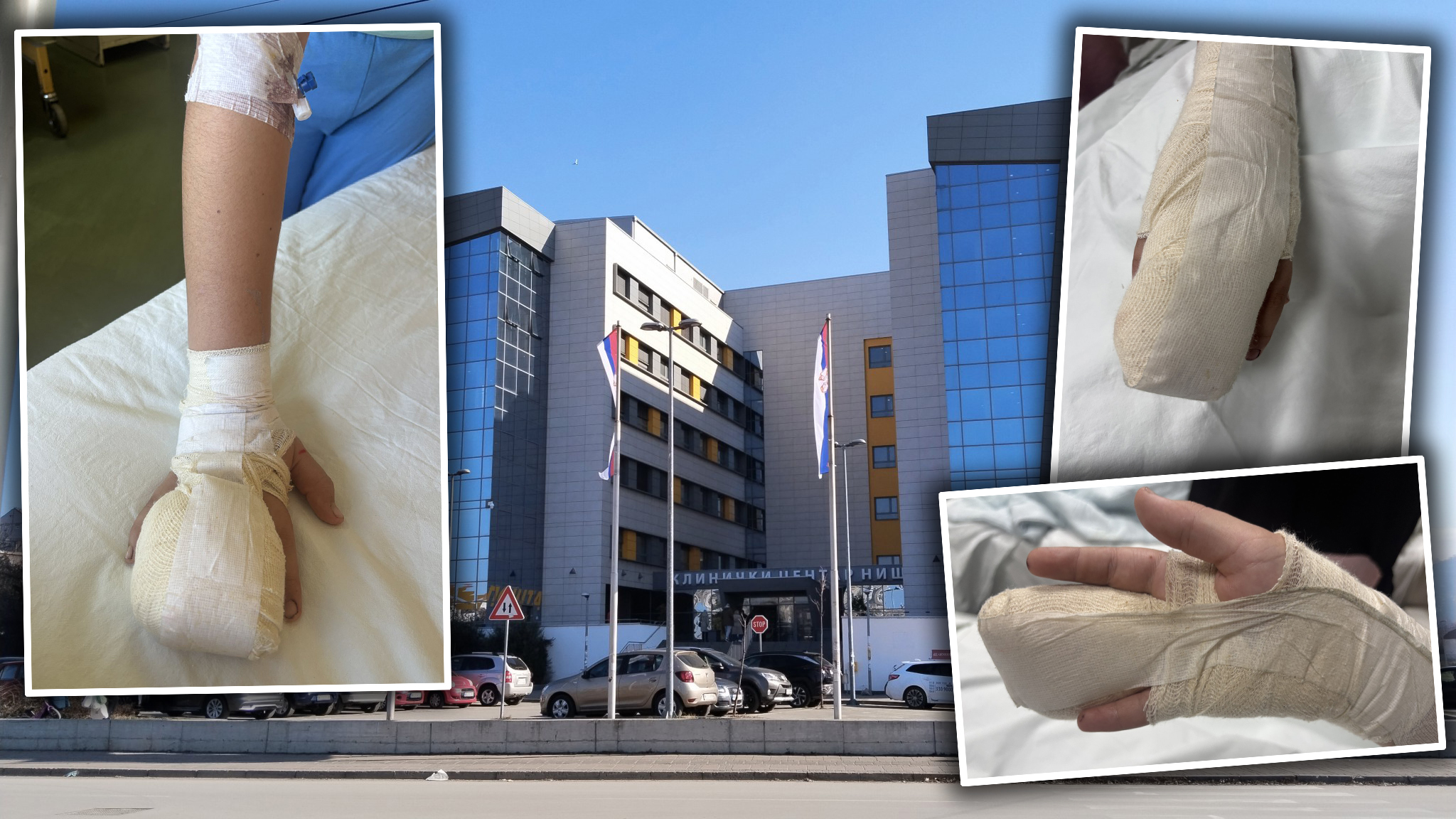 Niš, UKC Niš, Klinički centar Niš, pretučen dečak, povrede, kombo Foto: Miljana Isailović/Nova.rs/Privatna arhiva