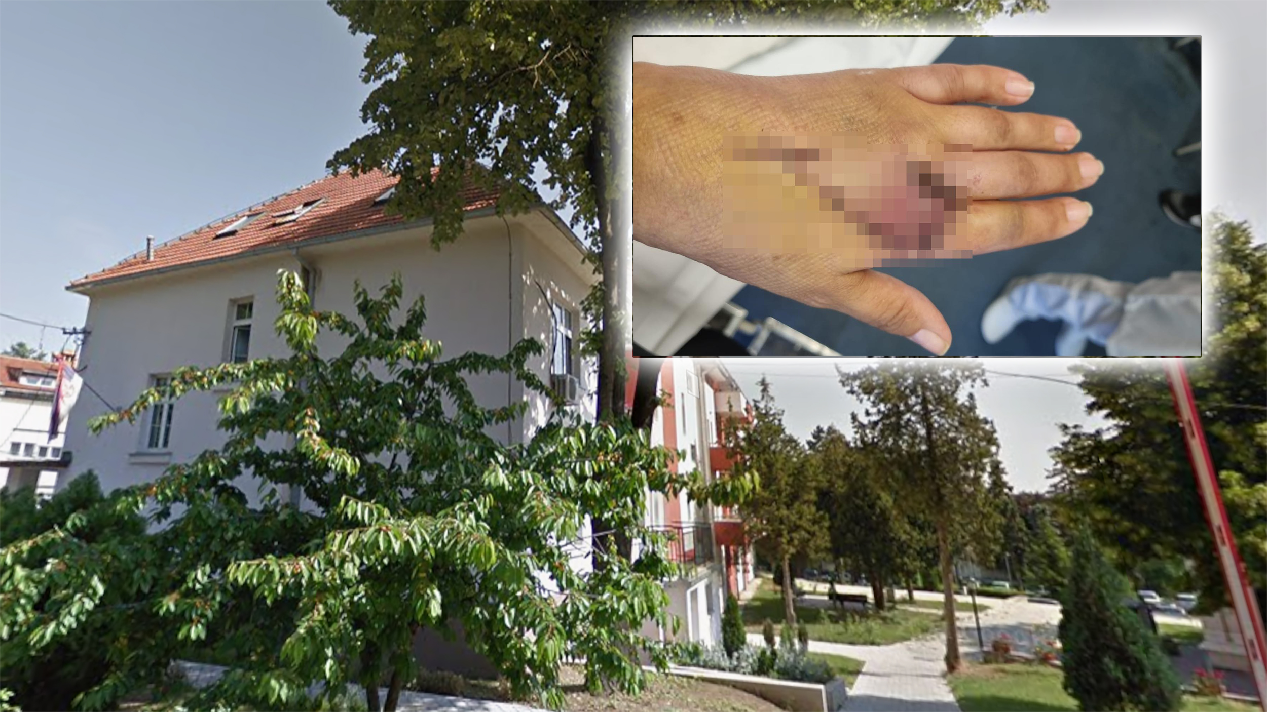 Klinika za rehabilitaciju dr Miroslav Zotović u Beogradu Strujni udar, Nataša Oluić iz Požege, povreda, bolnica, Beograd