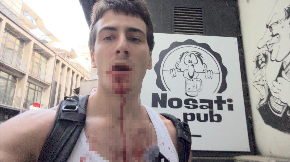 Jutjuber Neven Krstić napadnut u Ćacilendu Foto: Neven clips/privatna arhiva