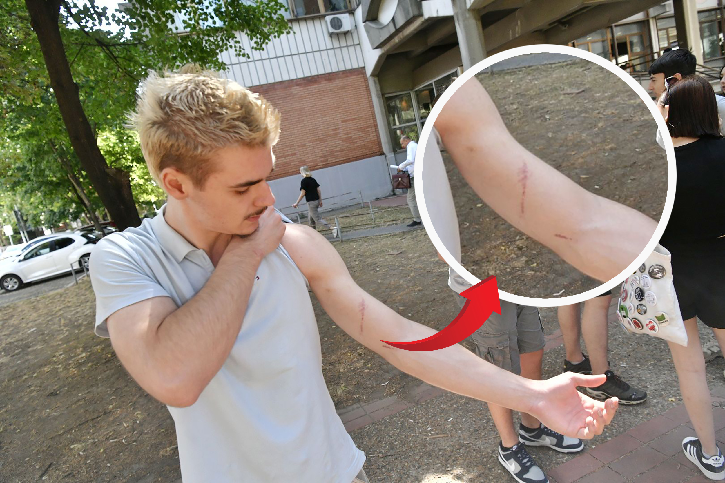 povrede prilikom hapsenja Boža Vasovića