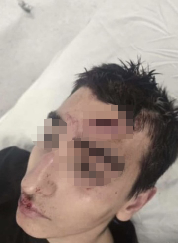 Prebijeno dete, otac Radomir Buš, Pančevo