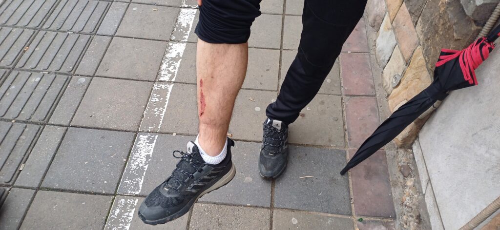 Milorad Bajić doživeo povredu u subotu na protestu, noć proveo na Urgentnom