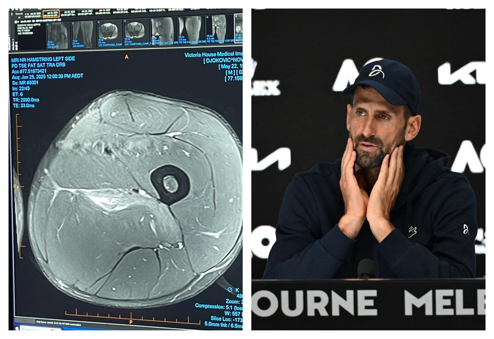 Foto: Screenshot X Djokernole; Profimedia Mark Avellino / AFP / Profimedia