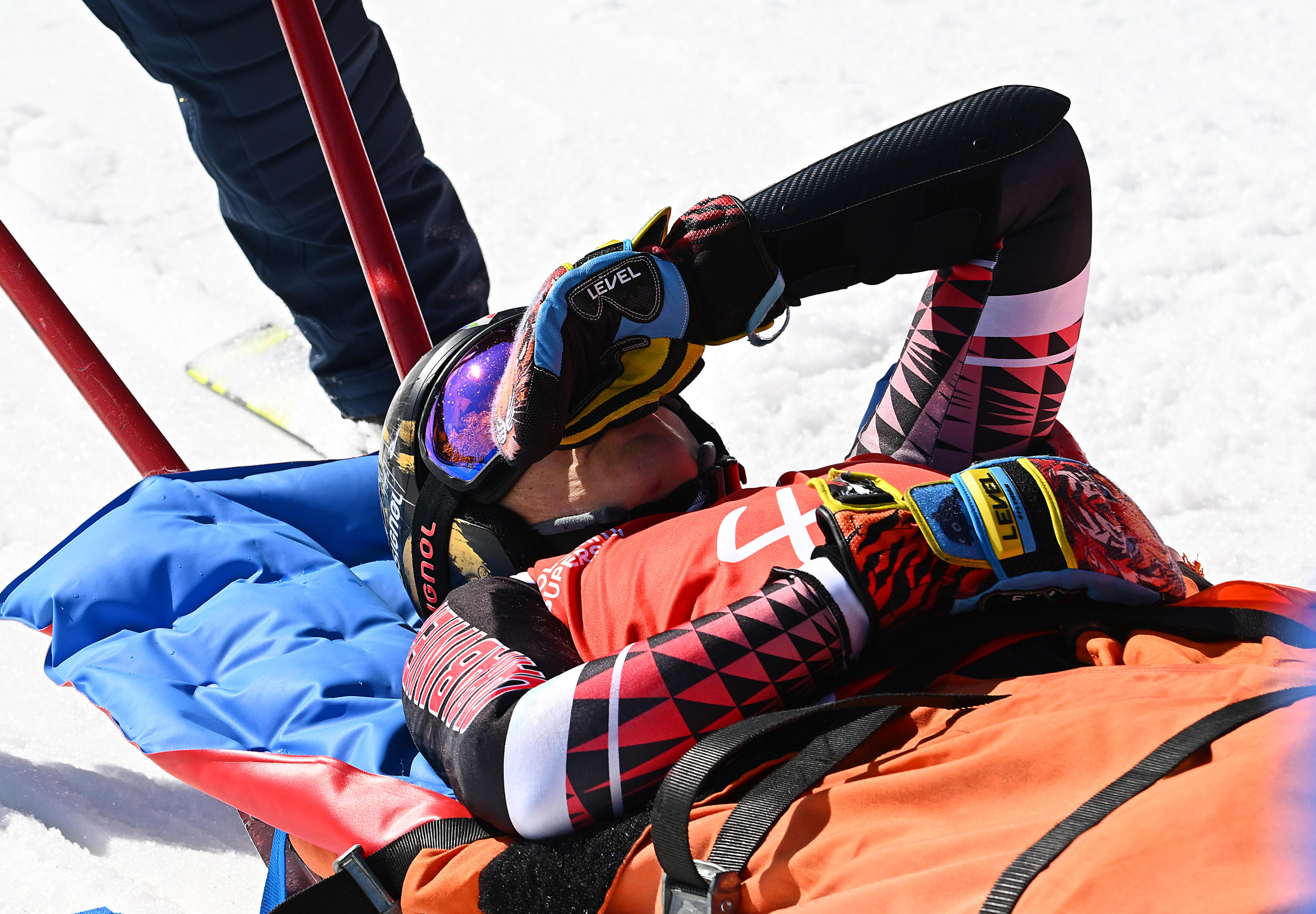 CRAC BRIGNONE, CADE E SI FRATTURA TIBIA E PERONE