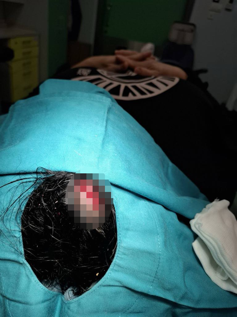 Povređena žena u Novom Sadu, pao joj crep na glavu, Novi Sad, žena, crep, povreda, glava Foto: Privatna arhiva
