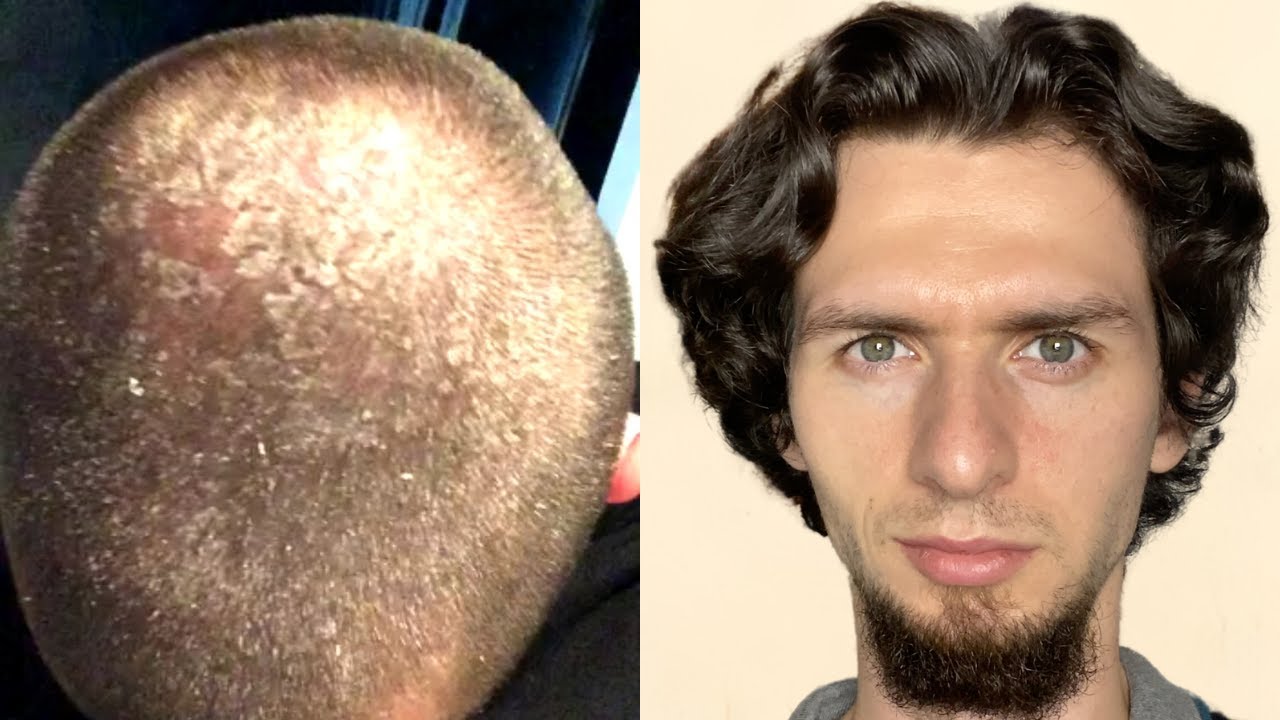 Osam godina nije koristio šampon