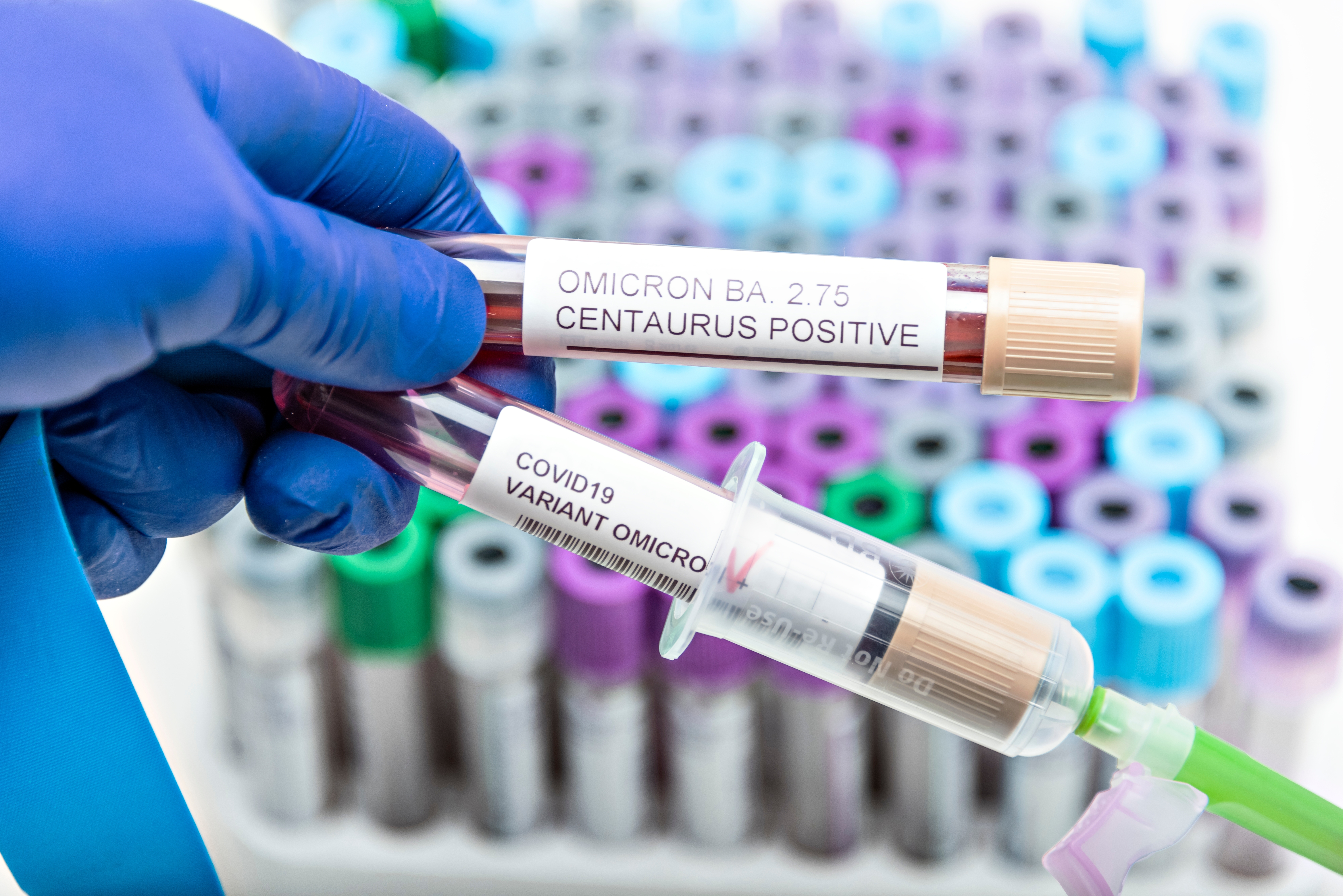 Positive,Blood,Infection,Sample,In,Test,Tube,For,Centaurus,Ba