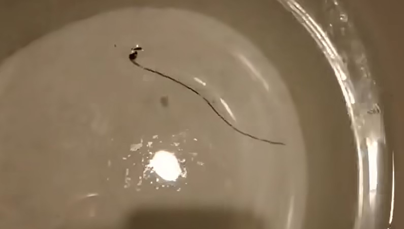 Parazit konjska dlaka u vodi u Bujanovcu