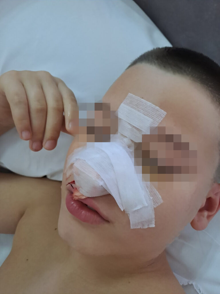 Jovan Vukobrat iz Mladenovca, pretucen u osnovnoj školi, majka Tamara Vukosavljević  Mladenovac