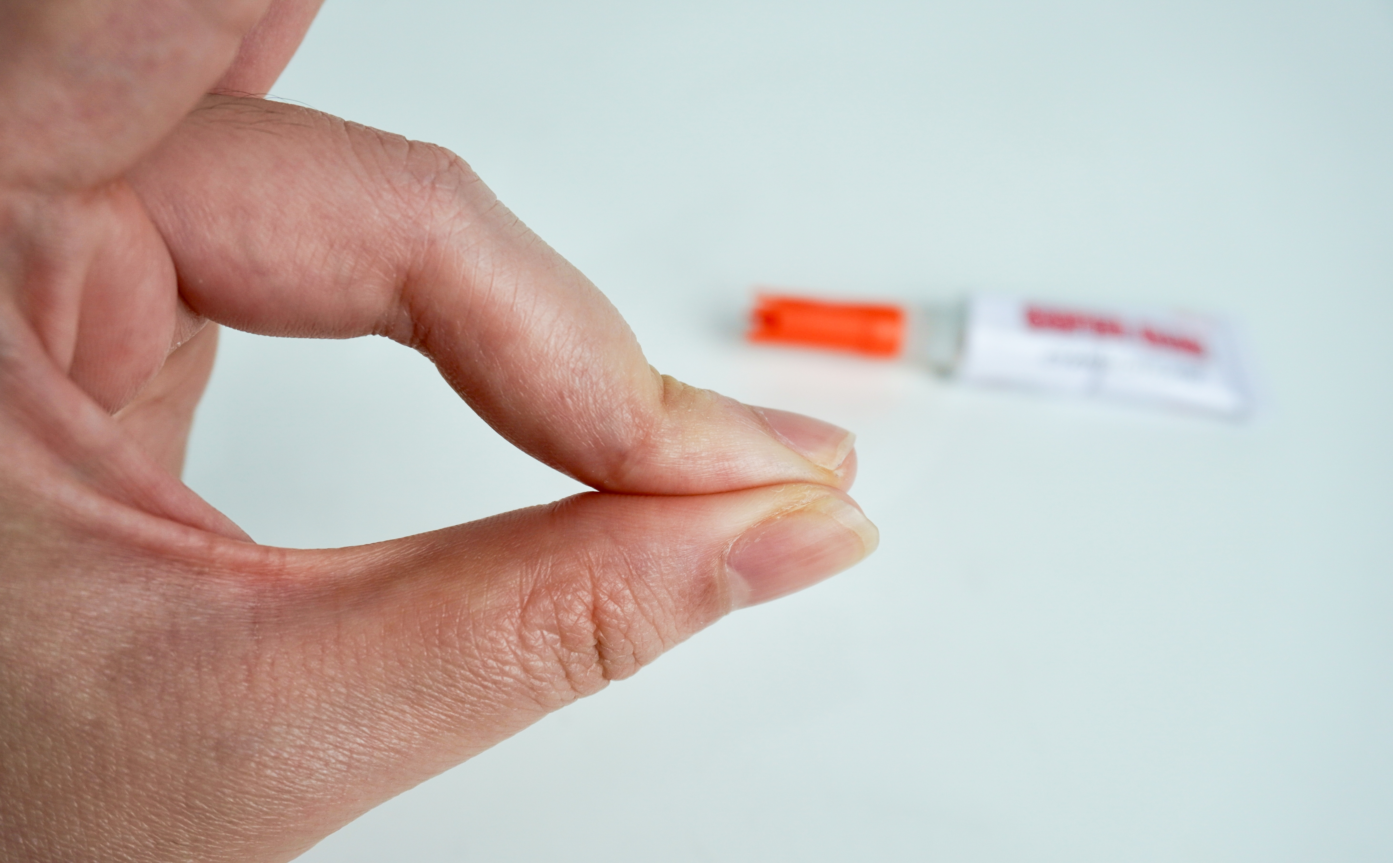 Prsti Kako skinuti super lepak sa kože