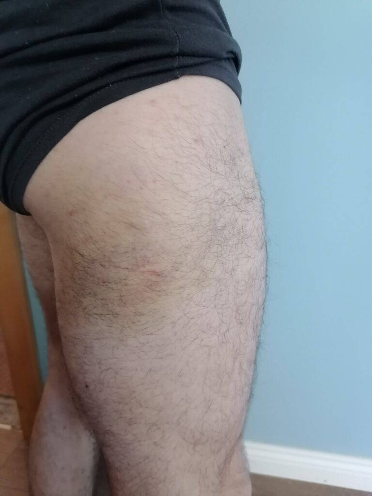 Radovan Đenadić iz Guče kog su pretukli policajci,