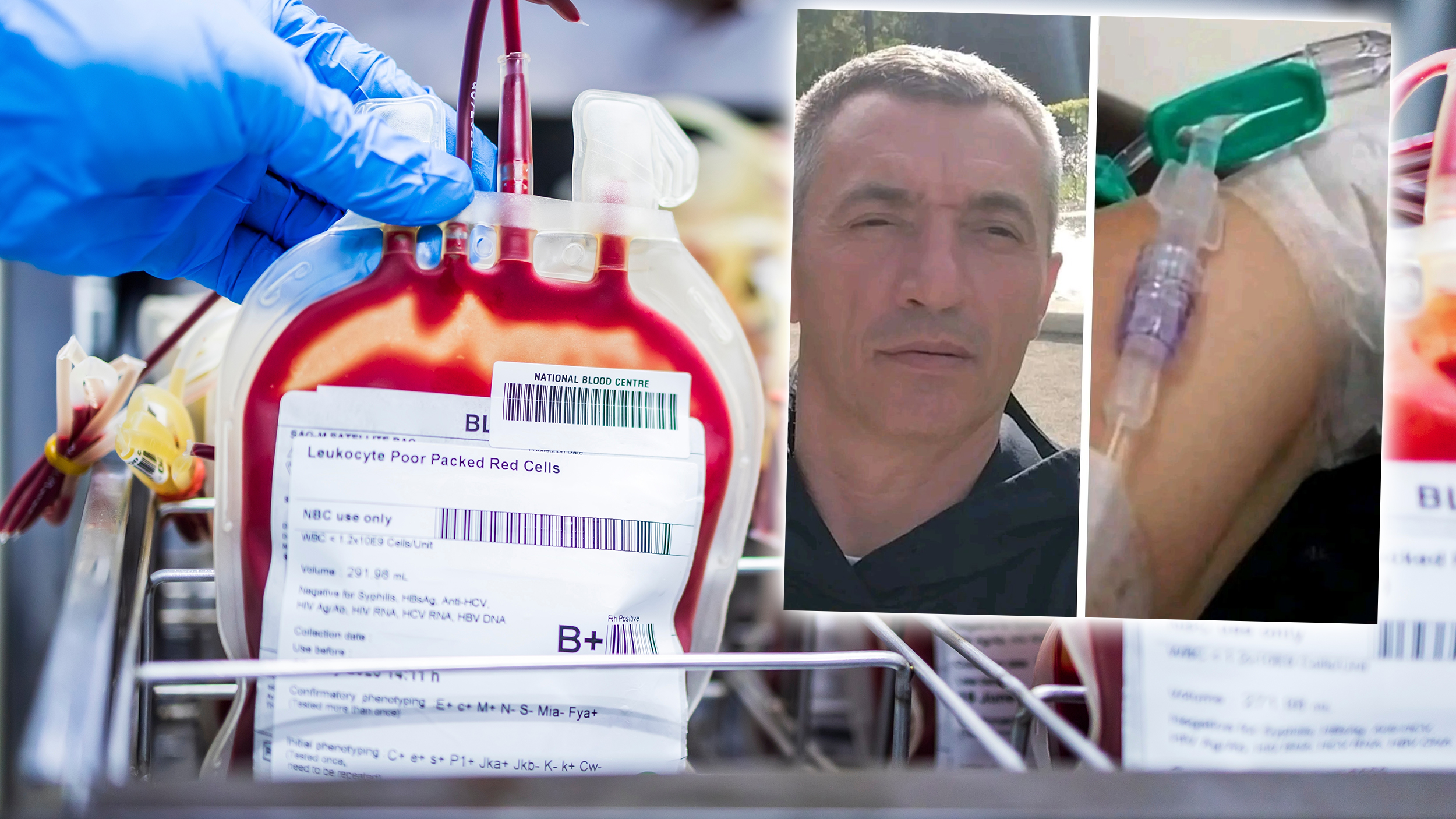 Leukocyte poor pack red cell in transfusion bag on a tray inside blood bank.Label as B Rh plus.Rare blood group prepares for donation or therapy of anemia patient in hospital.Many plastic bags. radenko infuzija