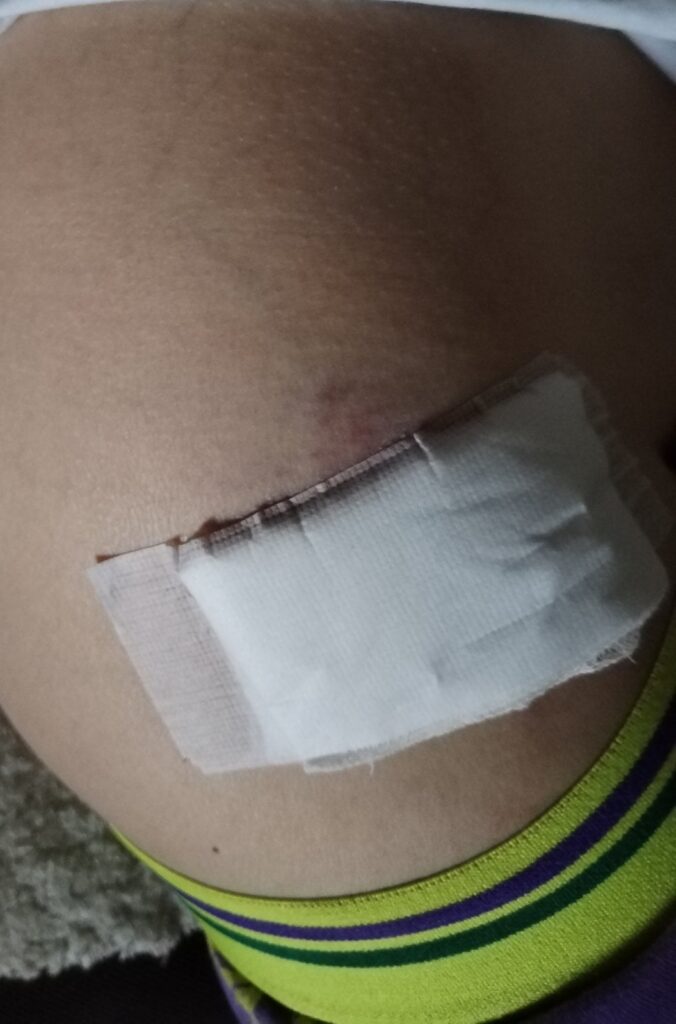za tekst o dečaku koji se povredio jer je upao u šaht
Foto privatna arhiva Milice J. uz njenu saglasnost