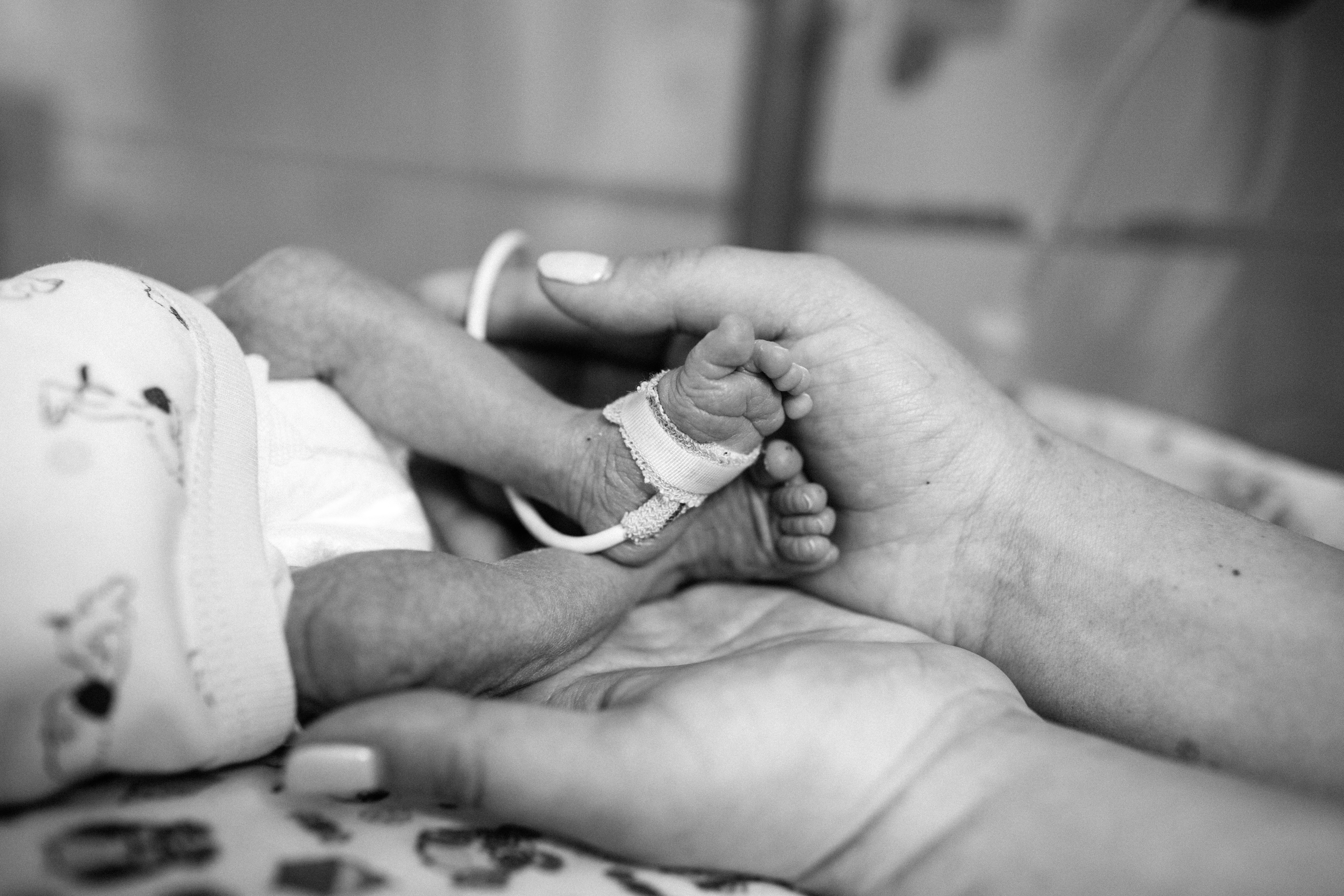 Premature,Baby,Legs,With,Neonatal,Infant,Pulse,Oximeter,In,Black