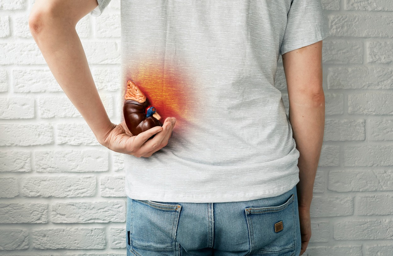 Kidney disease, conceptual image.,Image: 665845072, License: Royalty-free, Restrictions: Model Released, Model Release: yes, Credit line: PEAKSTOCK / Sciencephoto / Profimedia