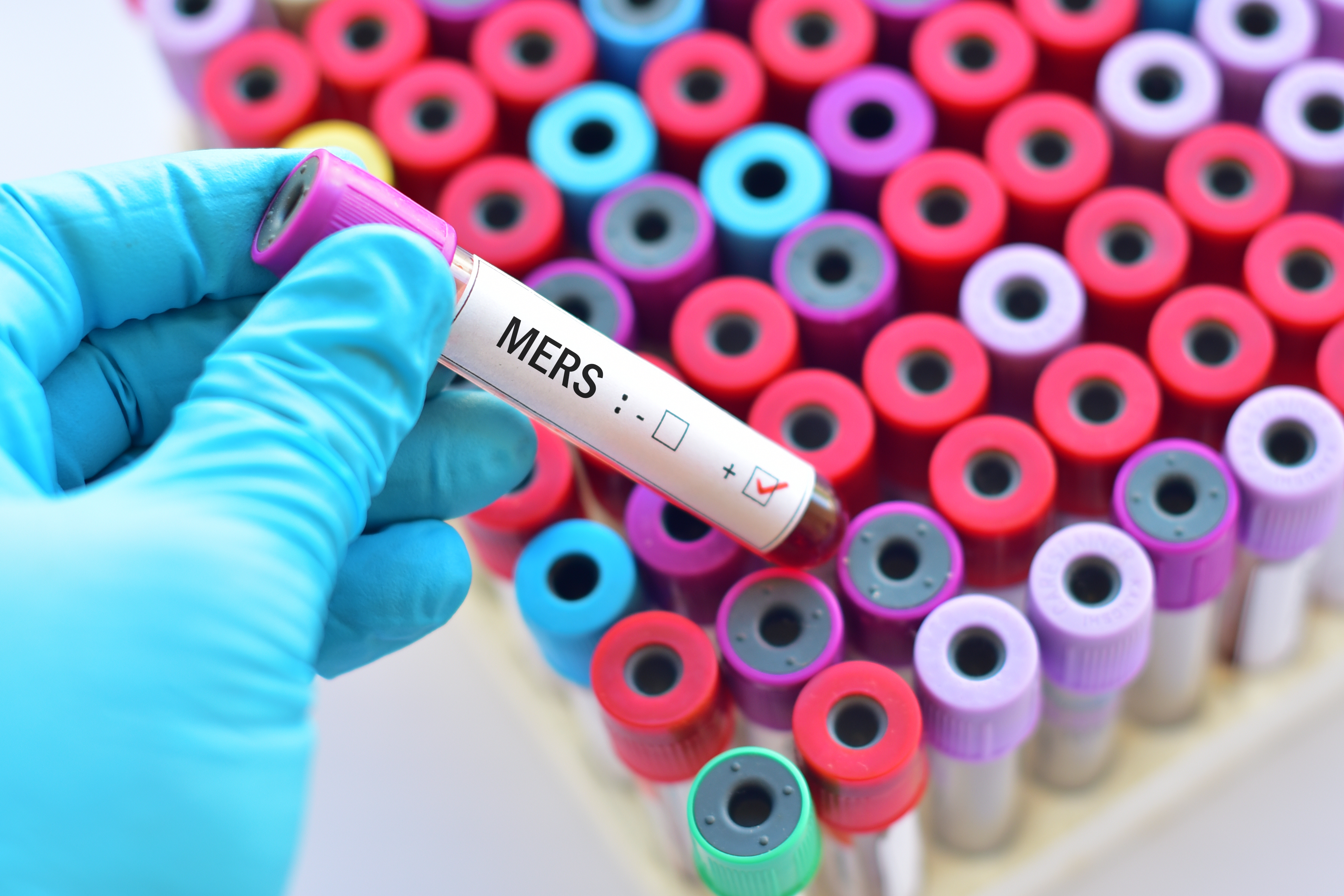 MERS viurs Foto: Shutterstock