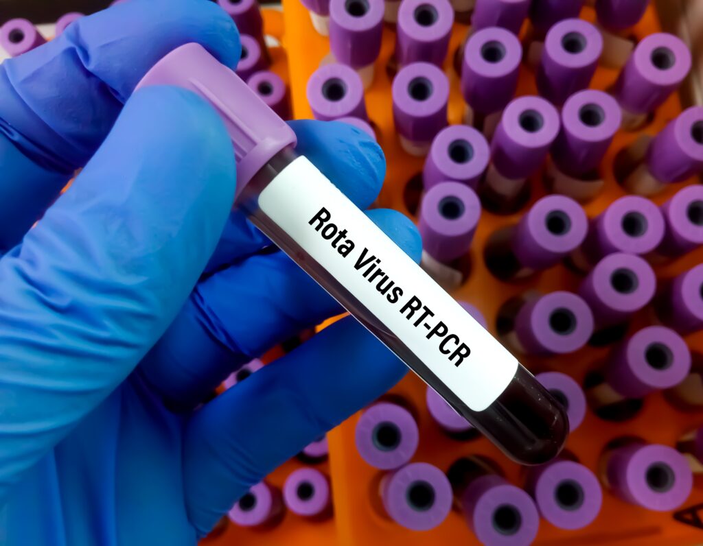 rotavirus