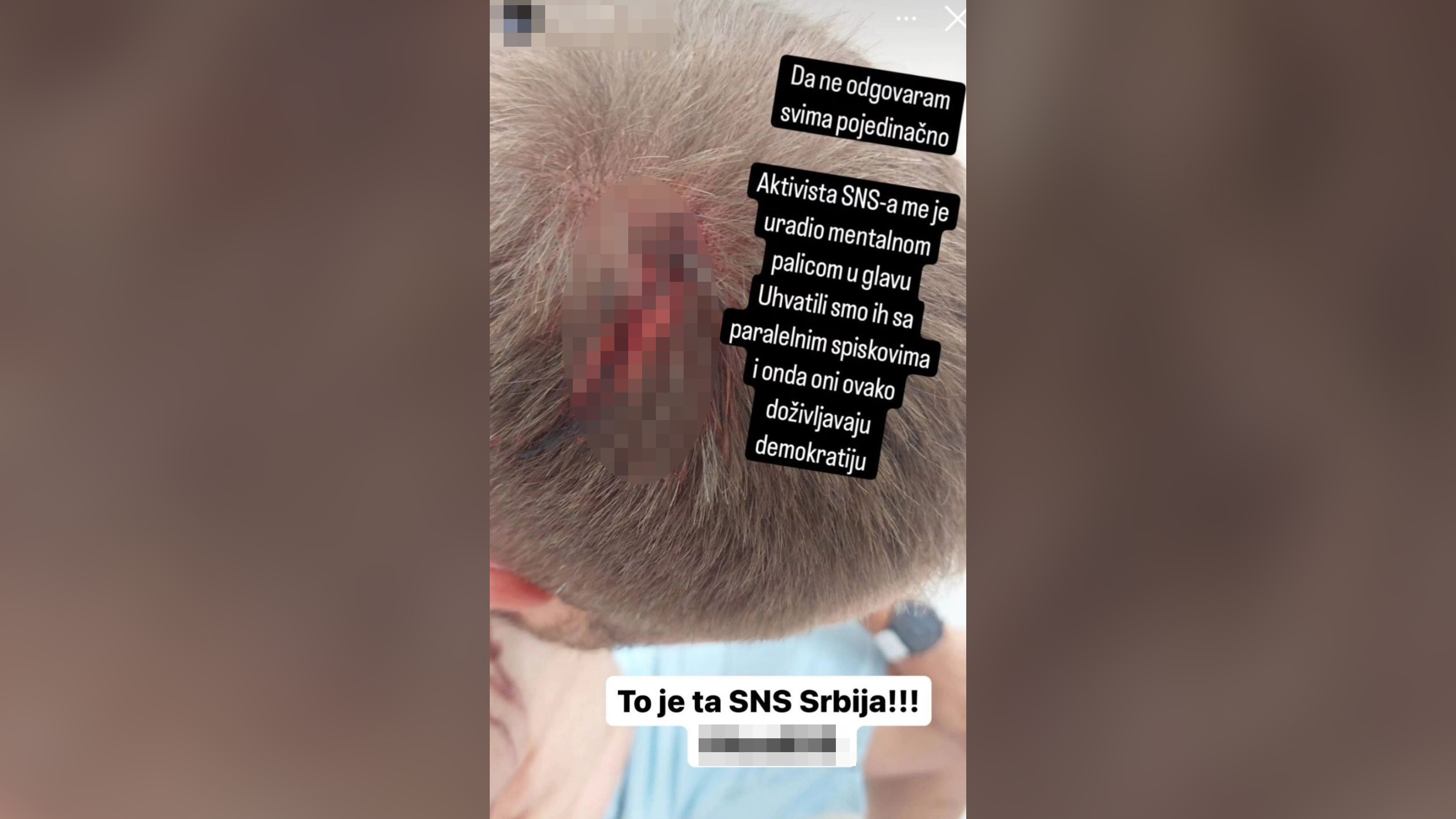 Povreda glave od strane aktiviste SNS