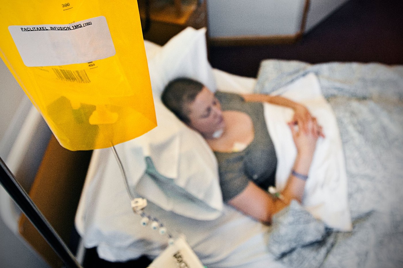 Patient Receiving Chemotherapy Treatment for Breast Cancer