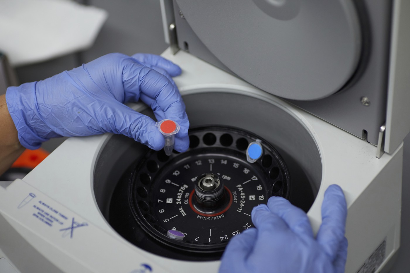 Attractive female scientist examinine testing bio material with medical equipment bloody spinning