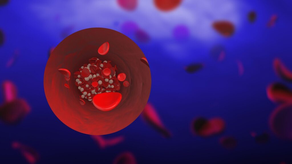 Image: 878017678, License: Royalty-free, Restrictions: , Model Release: no, Credit line: smita kurane / Alamy / Alamy / Profimedia